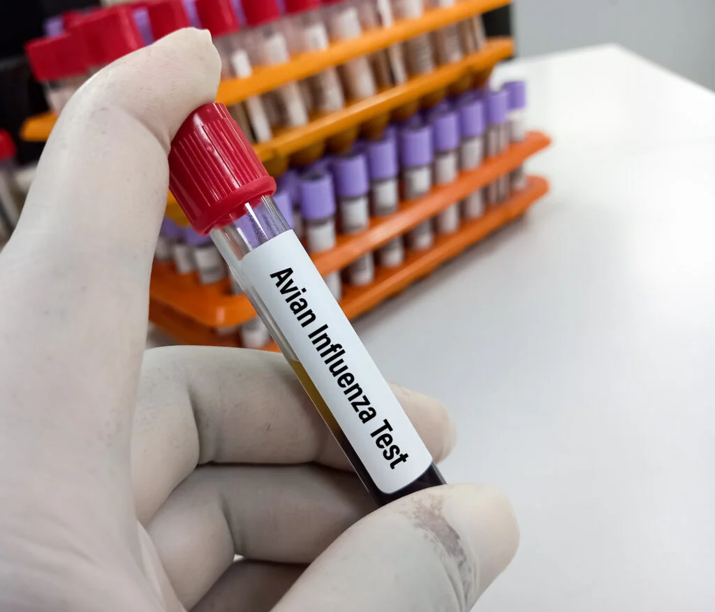 Blood Sample for H5N1 (Avian Influenza virus) test, avian influenza virus (AIV), avian flu or bird flu.